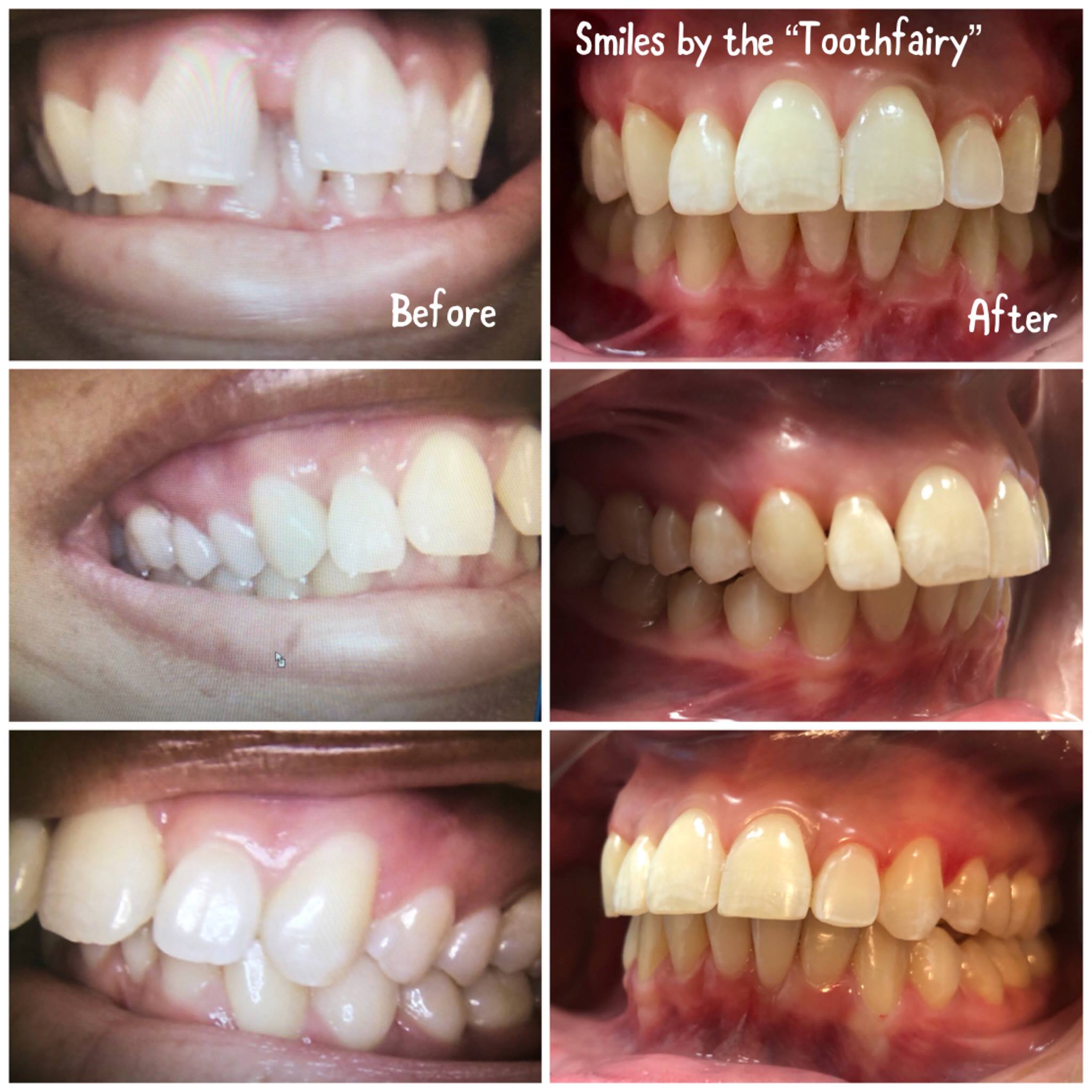 Farrey Family Dentistry Smile Gallery